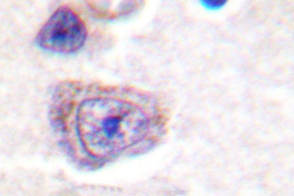 a00151y407 ptk2 primary antiboties ihc testing 2