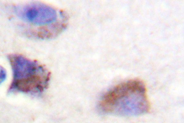 a00151y570 ptk2 primary antiboties ihc testing 2