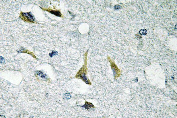 a00151y925 ptk2 primary antiboties ihc testing 2