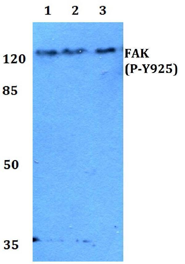a00151y925 ptk2 primary antiboties wb testing 1