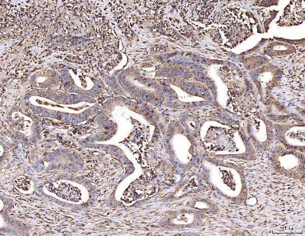  IHC analysis of CBL using anti-CBL antibody (A00152-2)