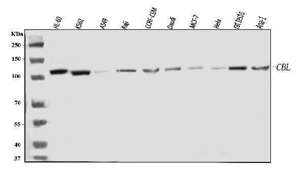  Western blot analysis of CBL using anti-CBL antibody (A00152-2)