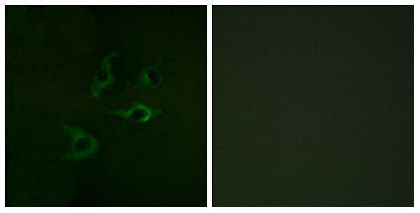 a00152 cbl primary antibodies if testing 1