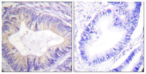 a00152 cbl primary antibodies ihc testing 4