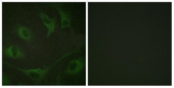 a00152y774 cbl primary antibodies if testing 1