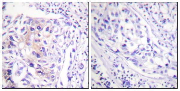a00152y774 cbl primary antibodies ihc testing 3