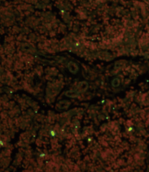 Immunofluorescence analysis of CD19 Antibody (N-term) with paraffin-embedded human lymph tissue. 0. 05 mg/ml primary antibody was followed by FITC-conjugated goat anti-rabbit lgG (whole molecule). FITC emits green fluorescence. Red counterstaining is PI. Immunofluorescence analysis of CD19 Antibody (N-term) with paraffin-embedded human lymph tissue. 0. 05 mg/ml primary antibody was followed by FITC-conjugated goat anti-rabbit lgG (whole molecule). FITC emits green fluorescence. Red counterstaining is PI.