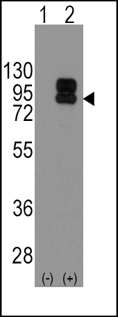 Western blot analysis of CD19 (arrow) using rabbit polyclonal CD19 Antibody (N-term) (Cat. #A00154). 293 cell lysates (2 ug/lane) either nontransfected (Lane 1) or transiently transfected with the CD19 gene (Lane 2) (Origene Technologies). Western blot analysis of CD19 (arrow) using rabbit polyclonal CD19 Antibody (N-term) (Cat. #A00154). 293 cell lysates (2 ug/lane) either nontransfected (Lane 1) or transiently transfected with the CD19 gene (Lane 2) (Origene Technologies).