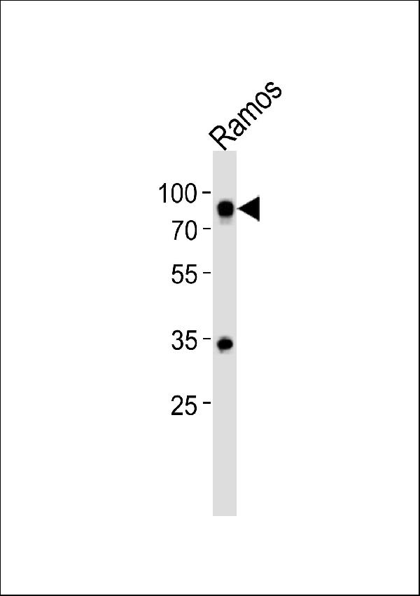 Western blot analysis of lysate from Ramos cell line, using CD19Antibody (N-term) (Cat. #A00154). A00154 was diluted at 1:500. A goat anti-rabbit IgG H&L (HRP) at 1:5000 dilution was used as the secondary antibody. Lysate at 35ug. Western blot analysis of lysate from Ramos cell line, using CD19Antibody (N-term) (Cat. #A00154). A00154 was diluted at 1:500. A goat anti-rabbit IgG H&L (HRP) at 1:5000 dilution was used as the secondary antibody. Lysate at 35ug.