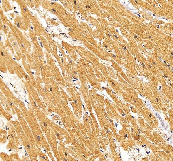 IHC analysis of RYR2 using anti-RYR2 antibody (A00155-2)