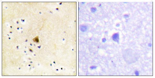 Immunohistochemistry analysis of paraffin-embedded human brain tissue, using RyR2 Antibody