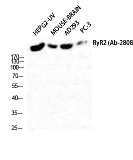 Western Blot analysis of HepG2-UV MOUSE-BRAIN AD293 PC-3 cells using RyR-2 Polyclonal Antibody diluted at 1:2000