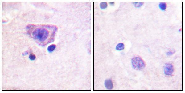Immunohistochemistry analysis of paraffin-embedded human brain, using RyR2 (Phospho-Ser2808) Antibody
