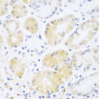 Immunohistochemistry of paraffin-embedded human stomach using C5 antibody at dilution of 1:100 (40x lens)