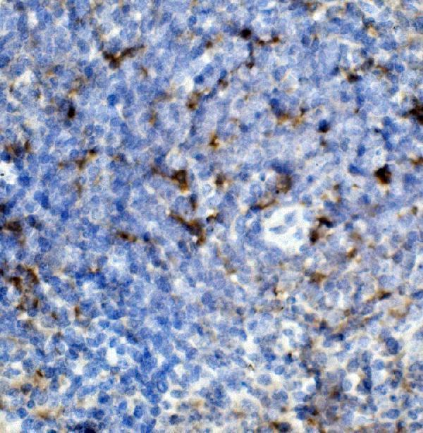 a00158 5 ccr2 primary antibodies ihc testing 2