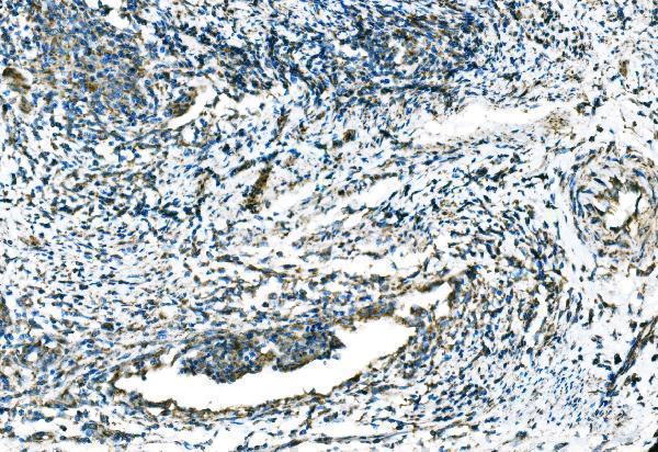  IHC analysis of CCR2 using anti-CCR2 antibody (A00158-7)