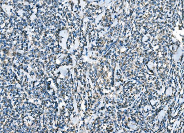  IHC analysis of CCR2 using anti-CCR2 antibody (A00158-7)
