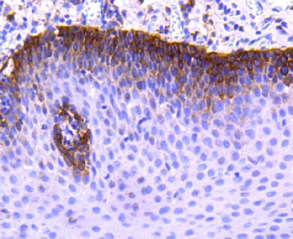 a00158 ccr2 primary antiboties ihc testing 1