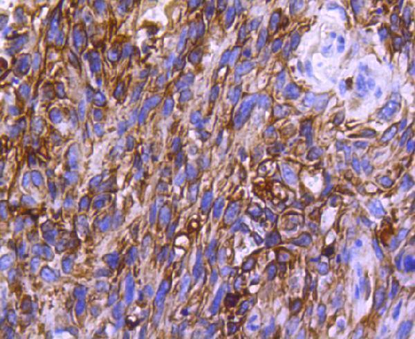 a00158 ccr2 primary antiboties ihc testing 2