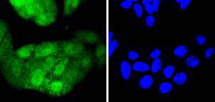 ICC staining Cdk4 in Hela cells (green)