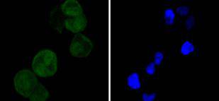 ICC staining Cdk4 in Hela cells (green)