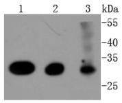 Western blot analysis of Cdk4 on different lysates using anti-Cdk4 antibody at 1/1,000 dilution