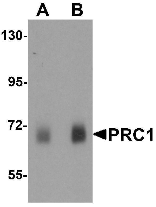 a00160 prc1 primary antibodies wb testing 1