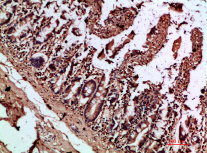 a00164 il17c primary antibodyes ihc testing 1