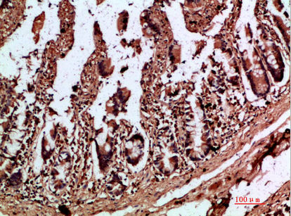 a00164 il17c primary antibodyes ihc testing 2