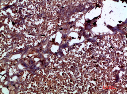 a00164 il17c primary antibodyes ihc testing 3