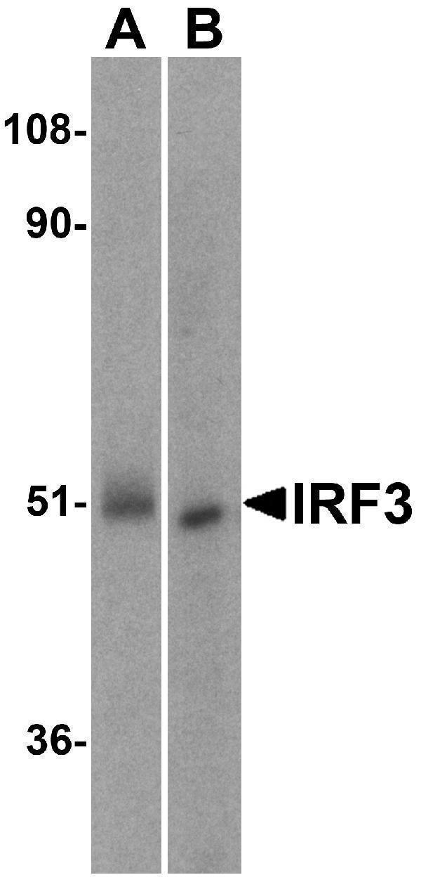 Western blot analysis of IRF3 in (A) human kidney and (B) rat kidney lysate with IRF3 antibody at 1 μg/mL