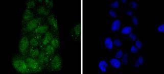 ICC staining IRF3 in Hela cells (green)