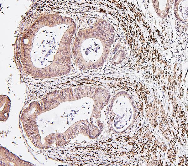 a00165 4 irf3 primary antibodies ihc testing 4