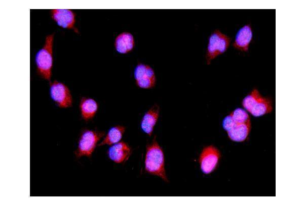 a00165 5 irf3 primary antibodies if testing 4