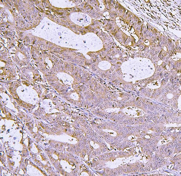 a00165 6 irf3 primary antibodies ihc testing 4