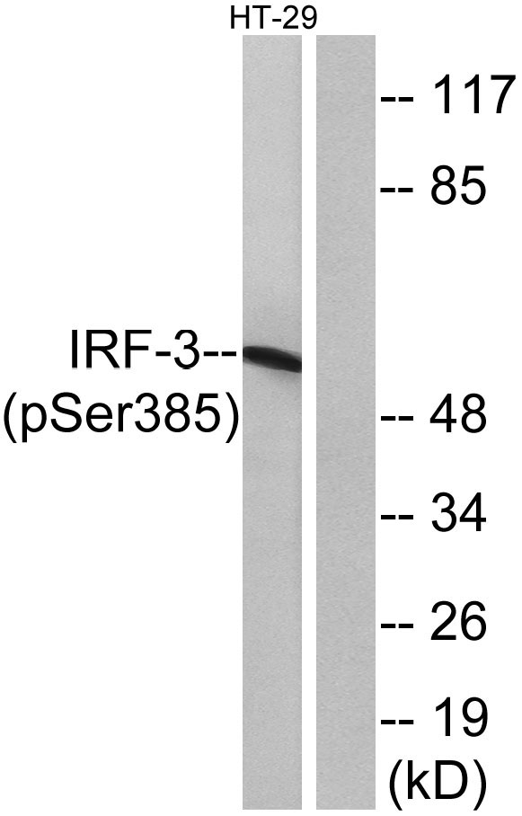 Immunohistochemistry analysis of paraffin-embedded human colon carcinoma, using IRF-3 (Phospho-Ser385) Antibody