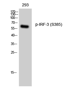 Western blot analysis of lysates from HT29 cells treated with INSULIN 0