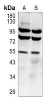 Western blot analysis of IRF3 (Phospho-S386) expression in Hela-LPS (A), HepG2 (B) whole cell lysates