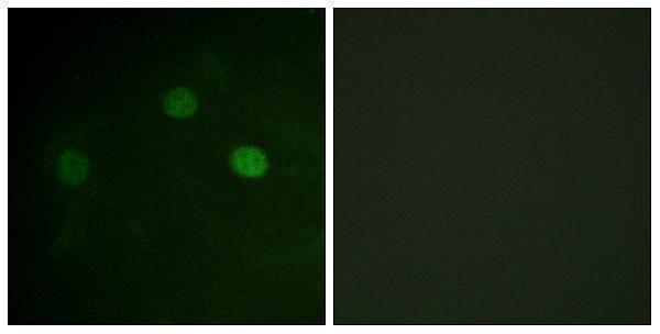 a00166t14 cdk2 primary antibodies if testing 1