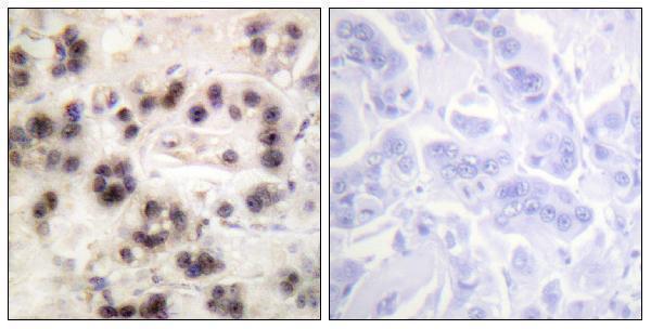 a00167s455 tp63 primary antibodies ihc testing 4