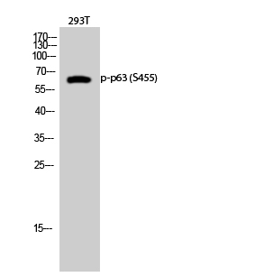 a00167s455 tp63 primary antibodies wb testing 2