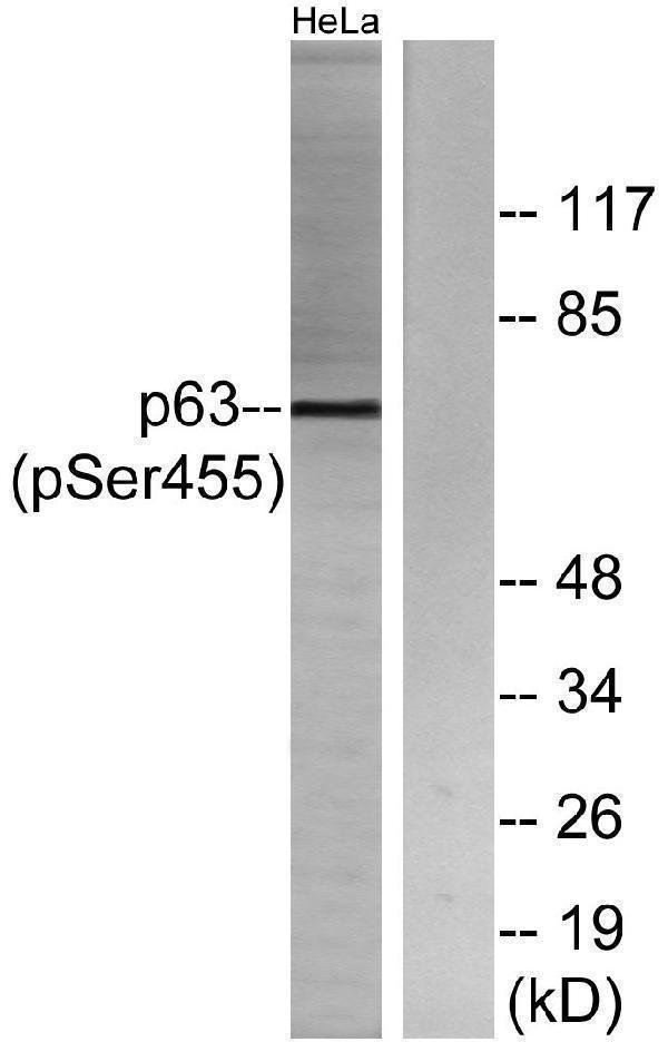 a00167s455 tp63 primary antibodies wb testing 3