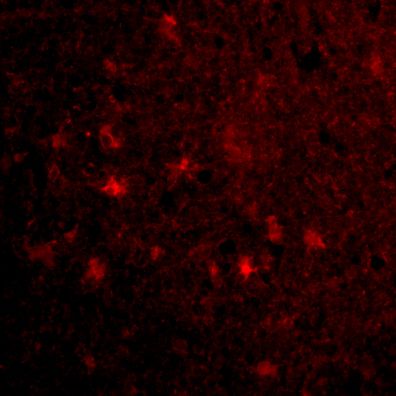 Immunofluorescence of VISA in Human Brain cells with VISA antibody at 20 μg/mL