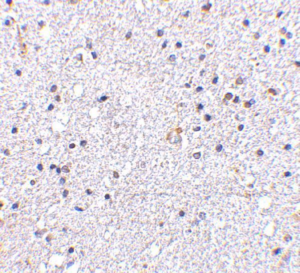 Immunohistochemistry of VISA in human brain tissue with VISA antibody at 5 μg/mL