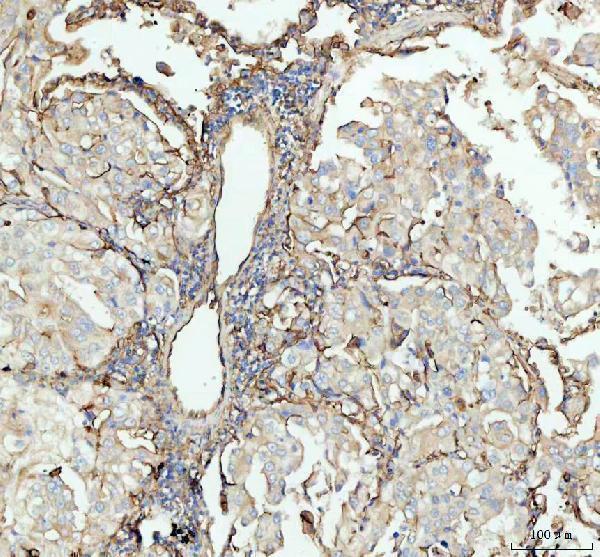 a00171 icam1 primary antibodies ihc testing 3_1