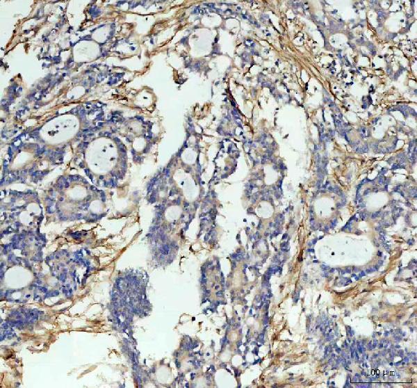 a00171 icam1 primary antibodies ihc testing 5