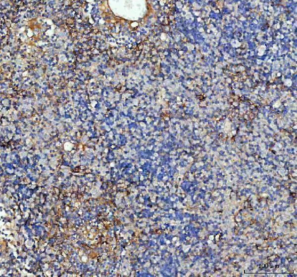 a00171 icam1 primary antibodies ihc testing 7