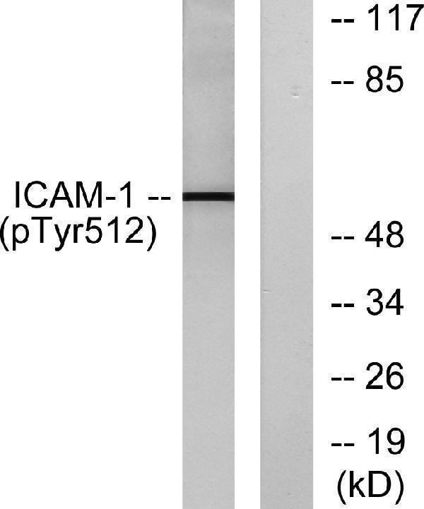 Western blot analysis of lysates from HeLa cells treated with TNF-alpha 20ng/ml 5