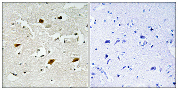 a00173t157 cdkn1b primary antibodies ihc testing 1