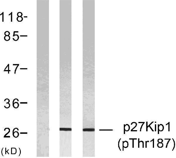 a00173t187 1 cdkn1b primary antibodies wb testing 3